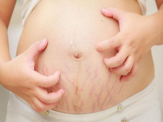 LO LẮNG, MẤT TỰ TIN VÌ RẠN DA – PHẢI LÀM SAO?